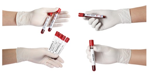 Image of Collage with photos of scientists holding test tubes with blood samples on white background, closeup. Banner design