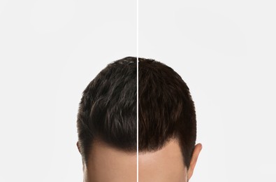 Closeup view of man before and after hair dyeing on light background, collage