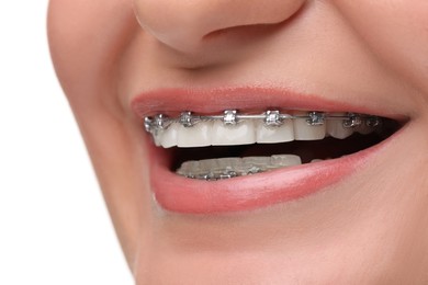 Photo of Smiling woman with dental braces on white background, closeup