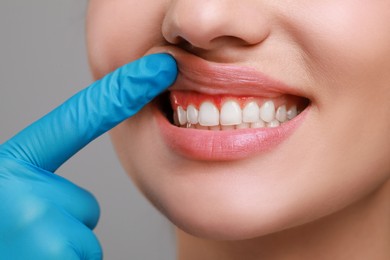 Doctor examining woman's inflamed gum on grey background, closeup