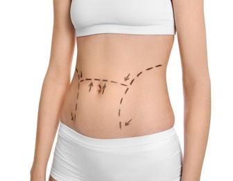 Photo of Young woman with marks on belly for cosmetic surgery operation against white background