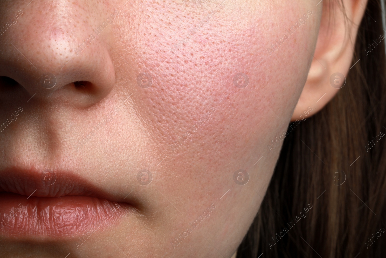 Photo of Closeup view of woman with normal skin