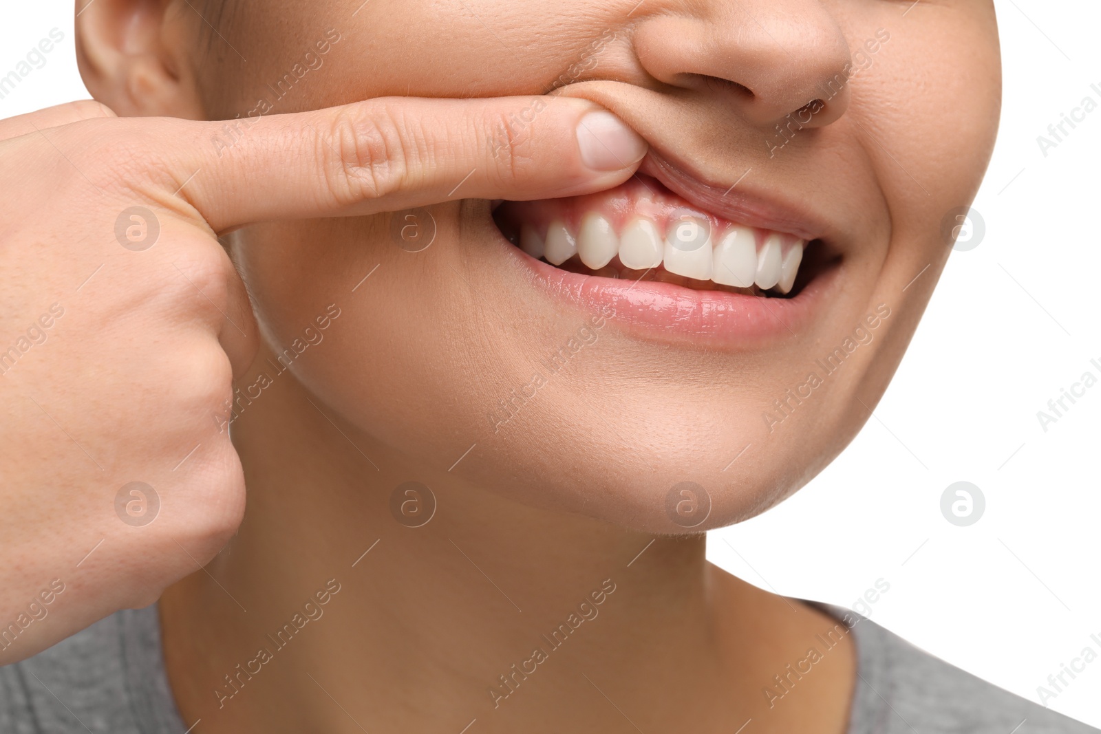 Photo of Woman showing her clean teeth on white background, closeup