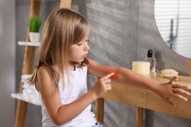 Photo of Suffering from allergy. Little girl looking at her arm in bathroom