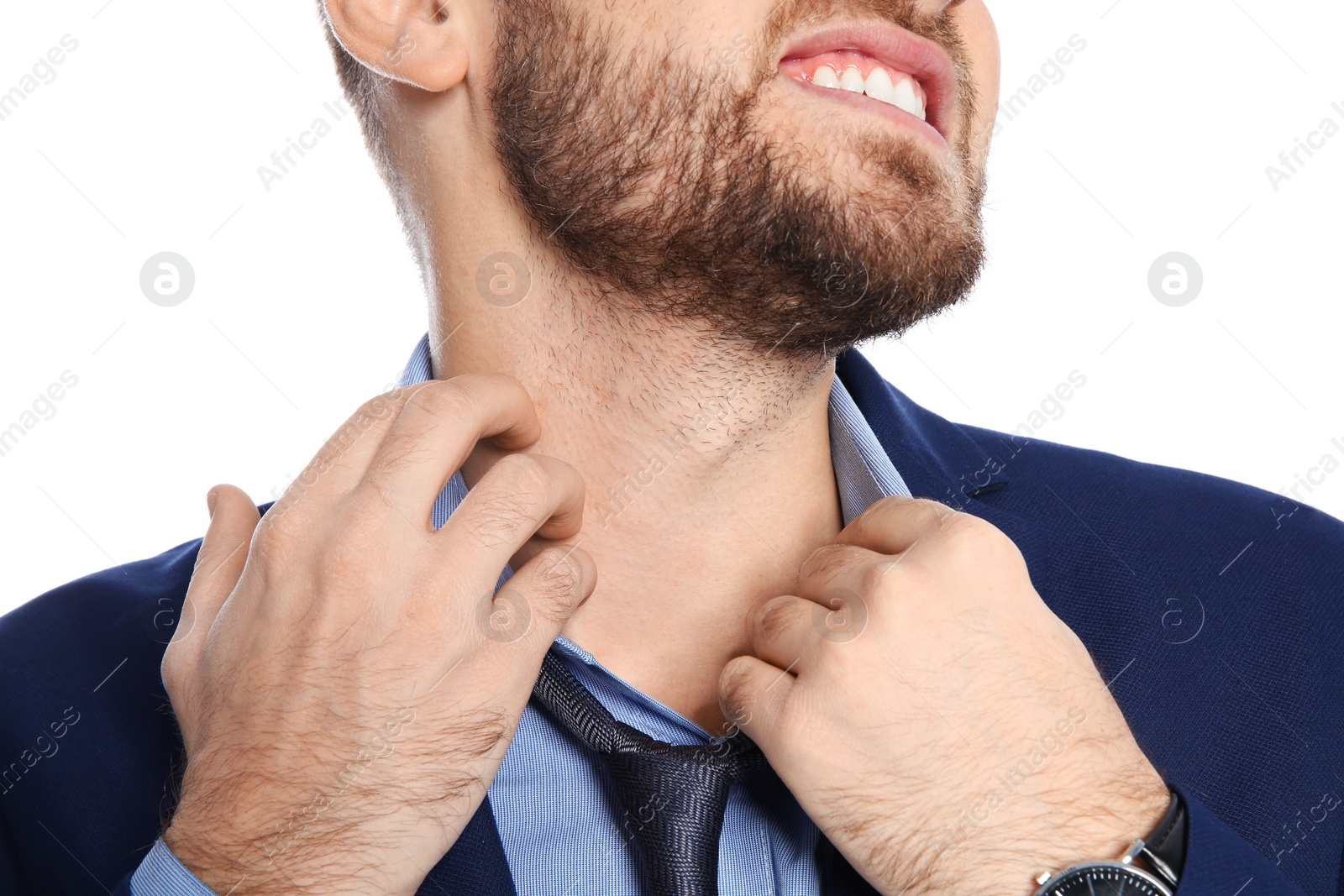 Photo of Young man scratching neck on white background, closeup. Annoying itch