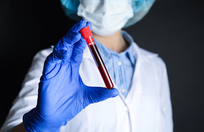 Photo of Scientist holding test tube with blood sample on black background, closeup. Virus research