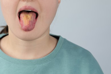 Photo of Gastrointestinal diseases. Woman showing her yellow tongue on light grey background, closeup