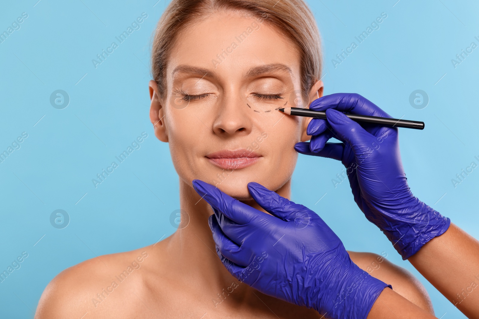 Photo of Doctor with pencil preparing patient for cosmetic surgery operation on light blue background, closeup