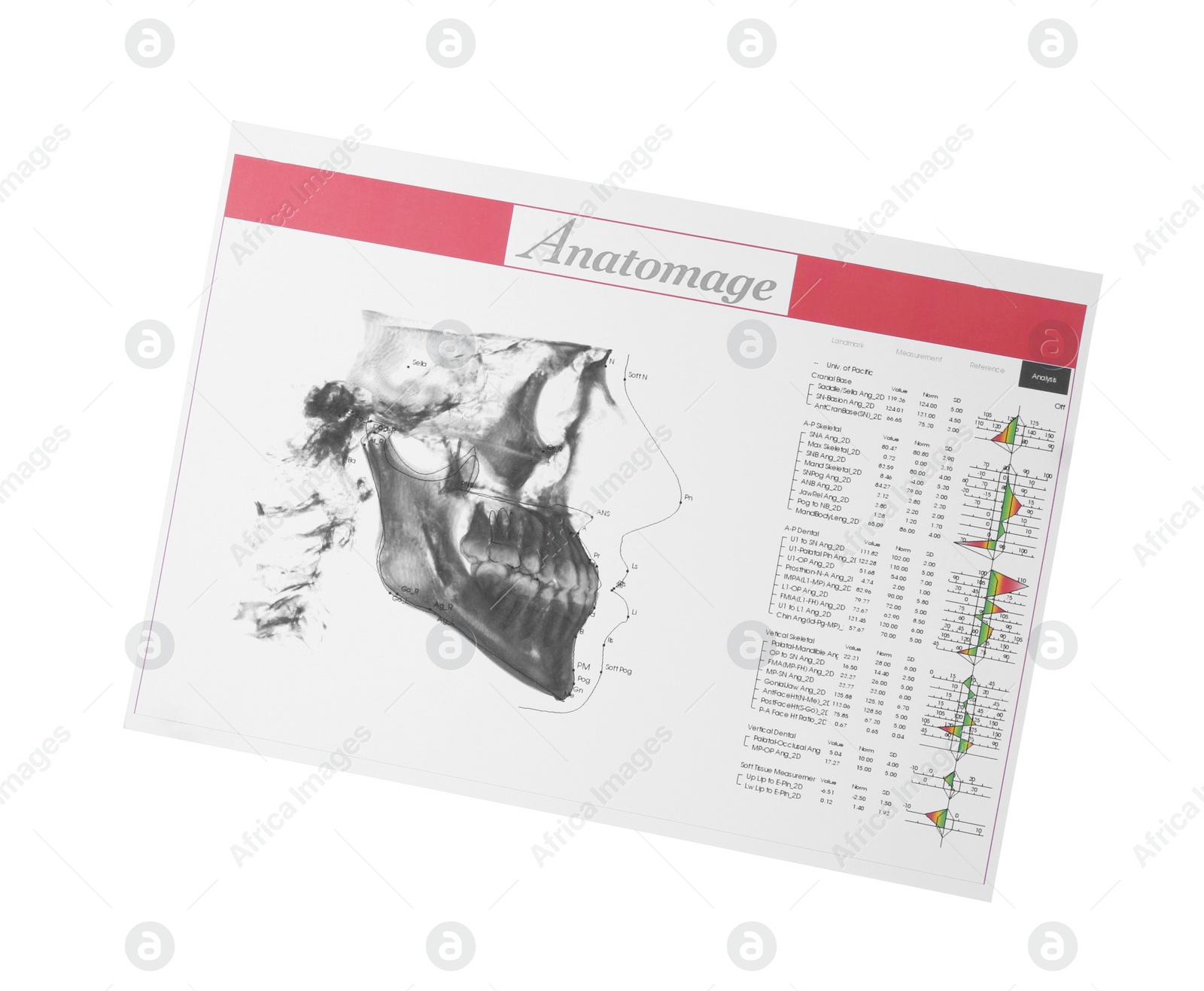 Photo of Visualization of human maxillofacial section for dental analysis printed on paper isolated on white