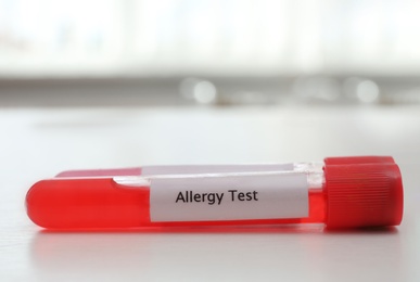 Photo of Tube with label ALLERGY TEST on white table