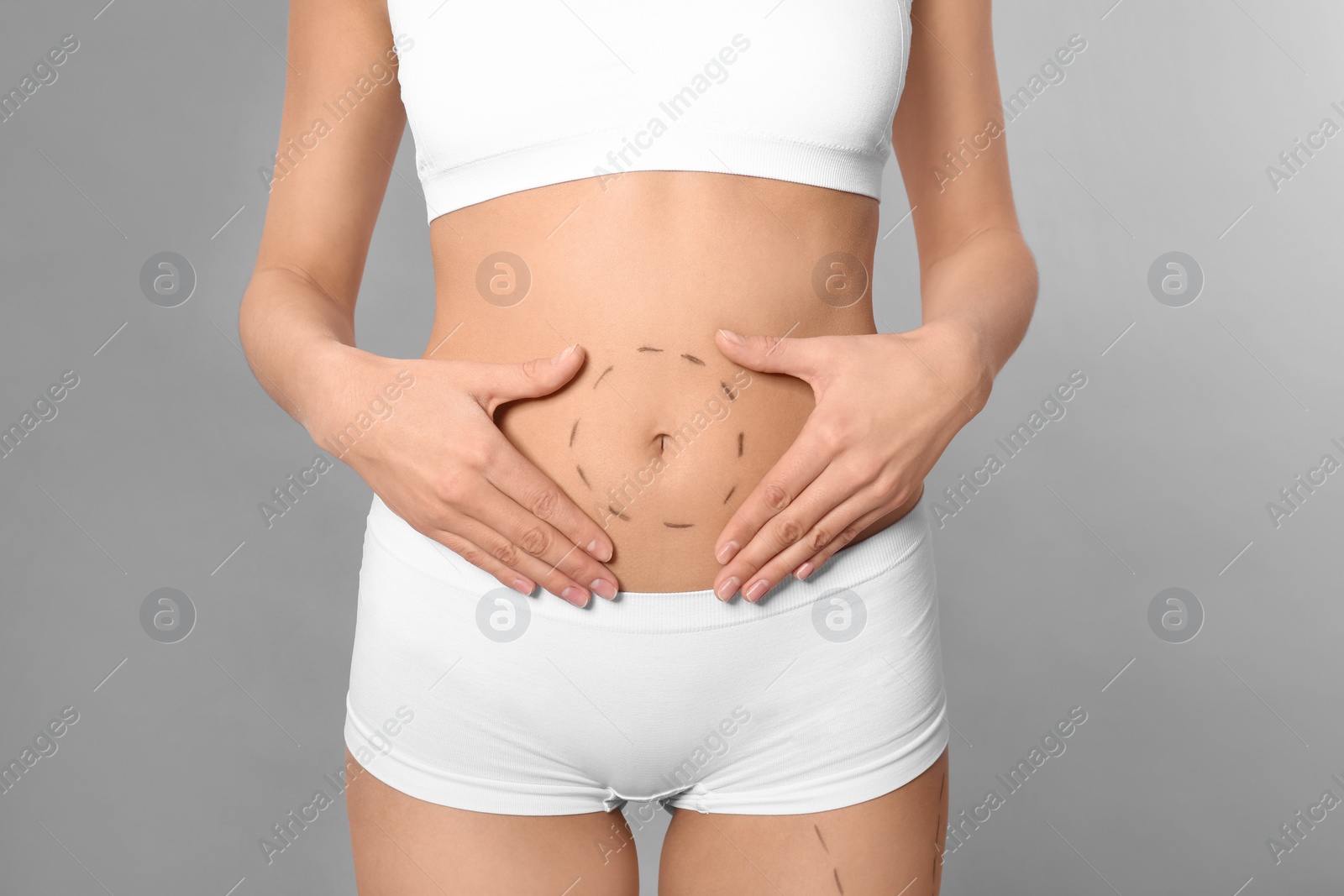 Photo of Young woman with marks on body for cosmetic surgery operation against grey background, closeup