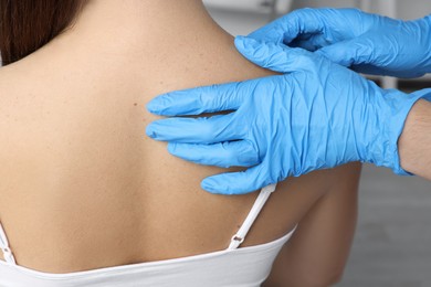 Dermatologist examining patient's birthmark in clinic, closeup