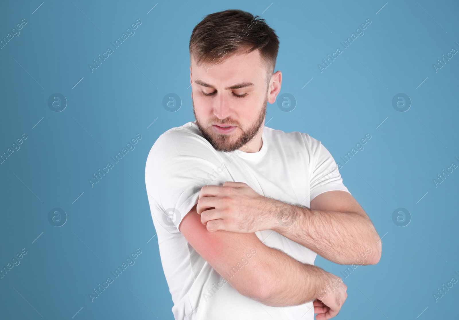 Photo of Man scratching arm on color background. Allergy symptoms