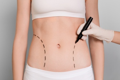 Doctor drawing marks on female belly for cosmetic surgery operation, closeup