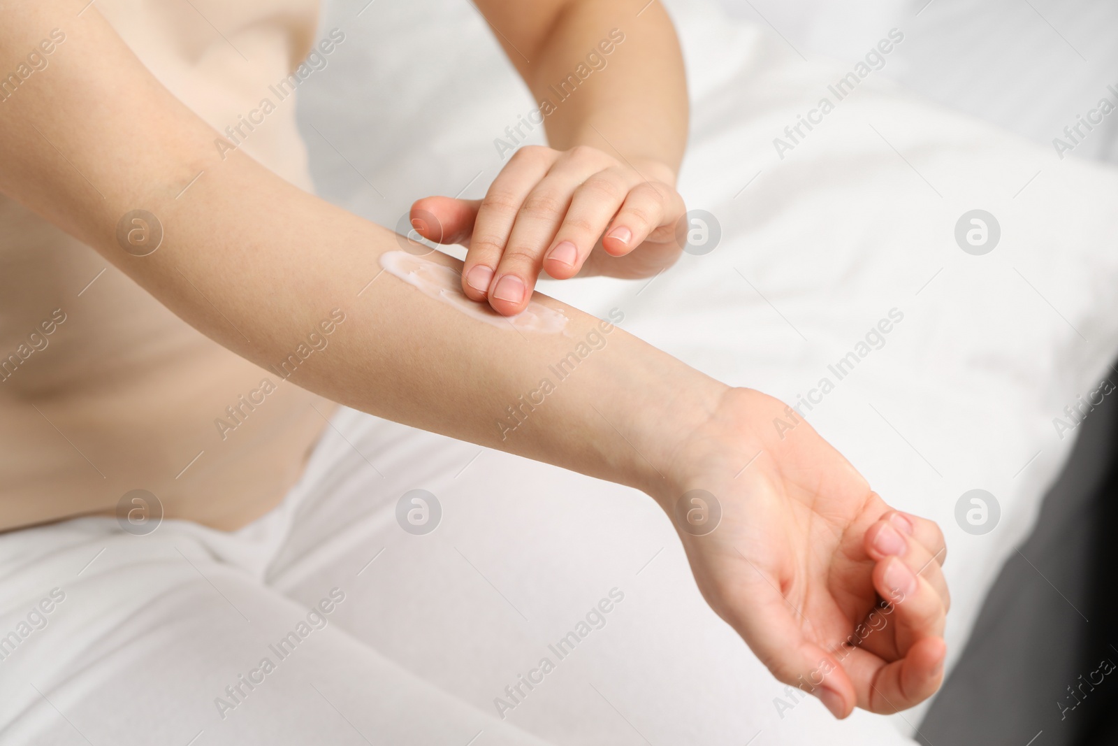 Photo of Young woman with dry skin applying cream onto her arm on bed, closeup