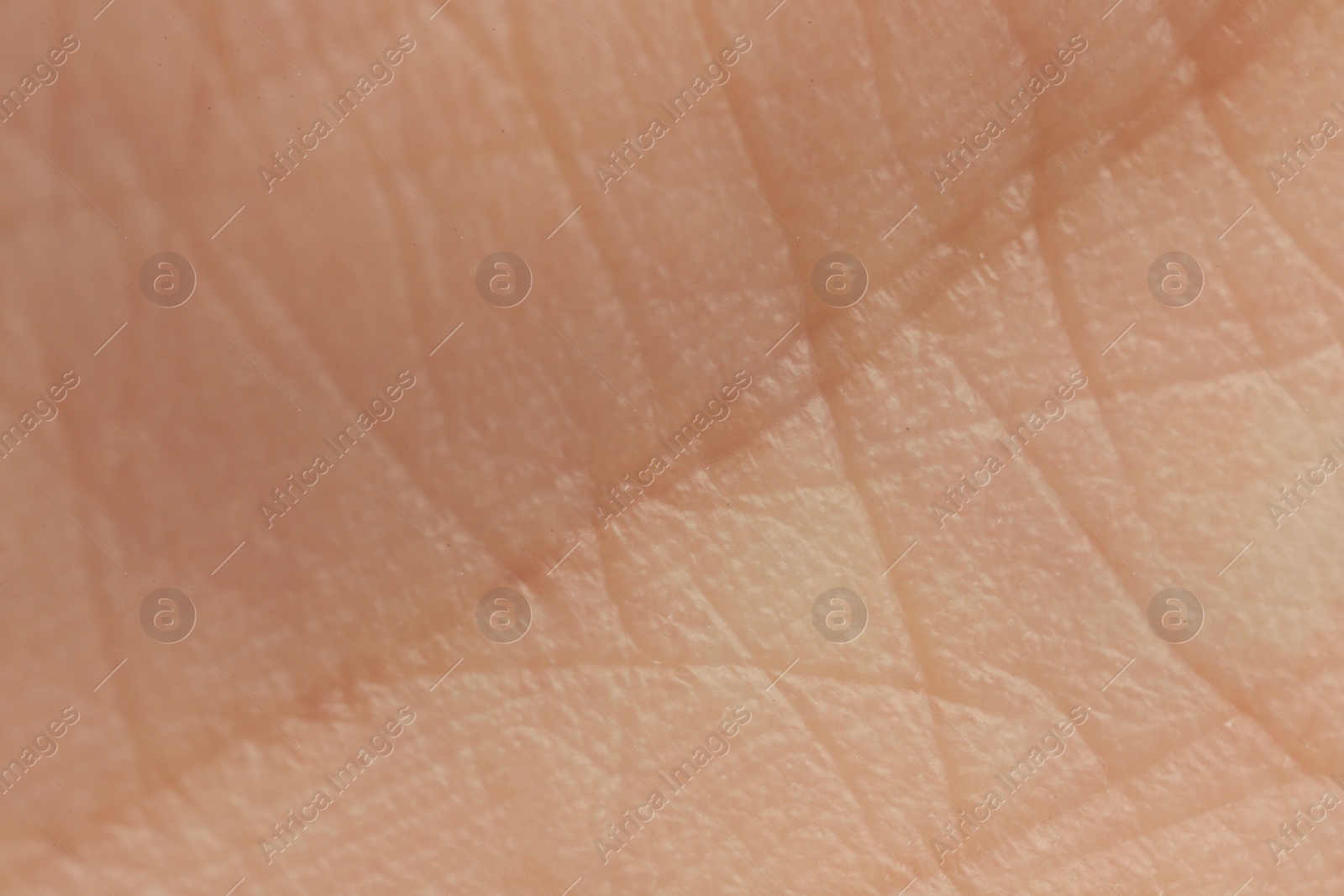 Photo of Texture of dry skin as background, macro view