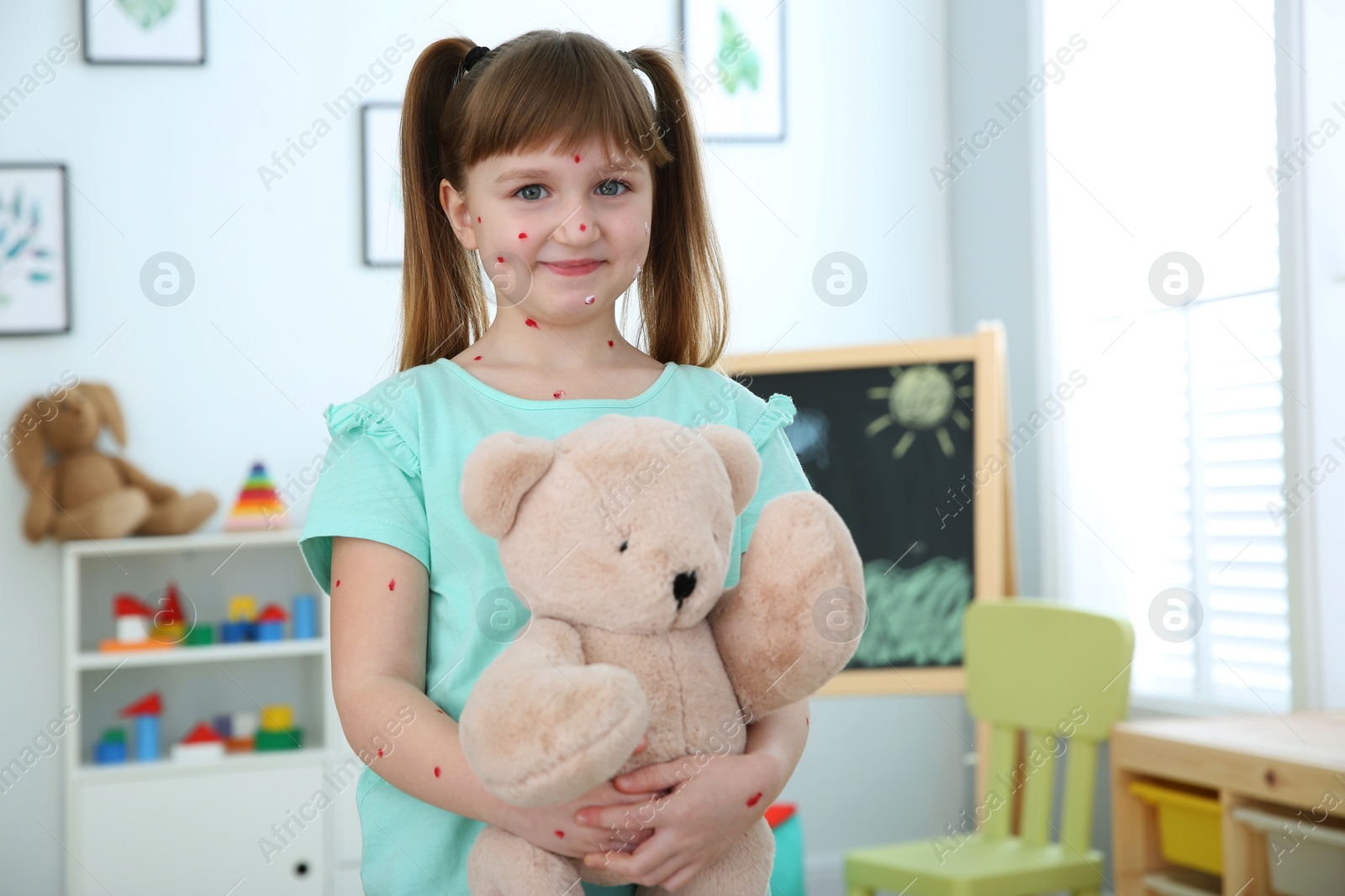 Photo of Little girl with chickenpox holding teddy bear at home