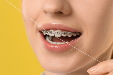 Photo of Woman with braces cleaning teeth using dental floss on yellow background, closeup
