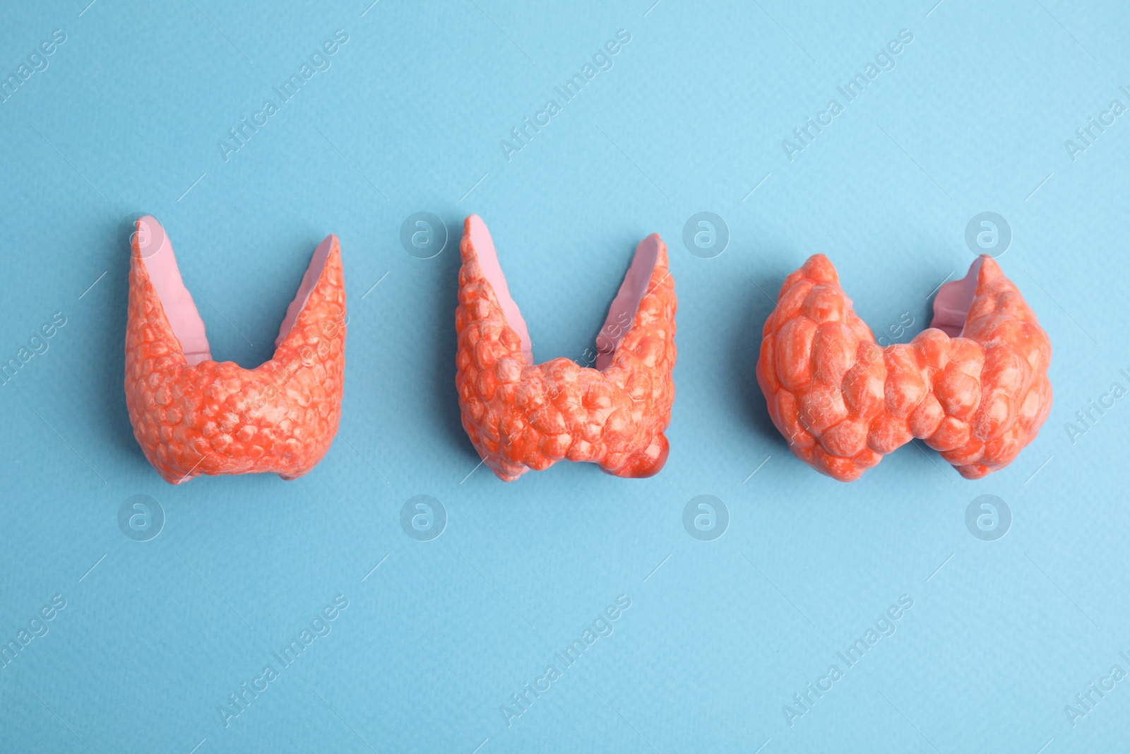 Photo of Plastic models of healthy and afflicted thyroids on light blue background, flat lay