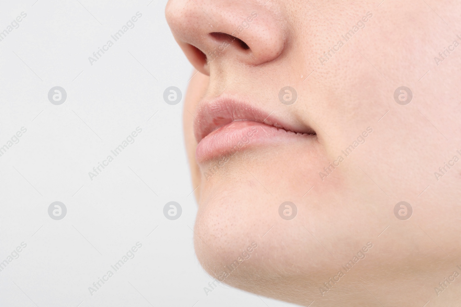 Photo of Woman with dry skin on white background, closeup view. Space for text