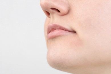 Woman with dry skin on white background, closeup view. Space for text