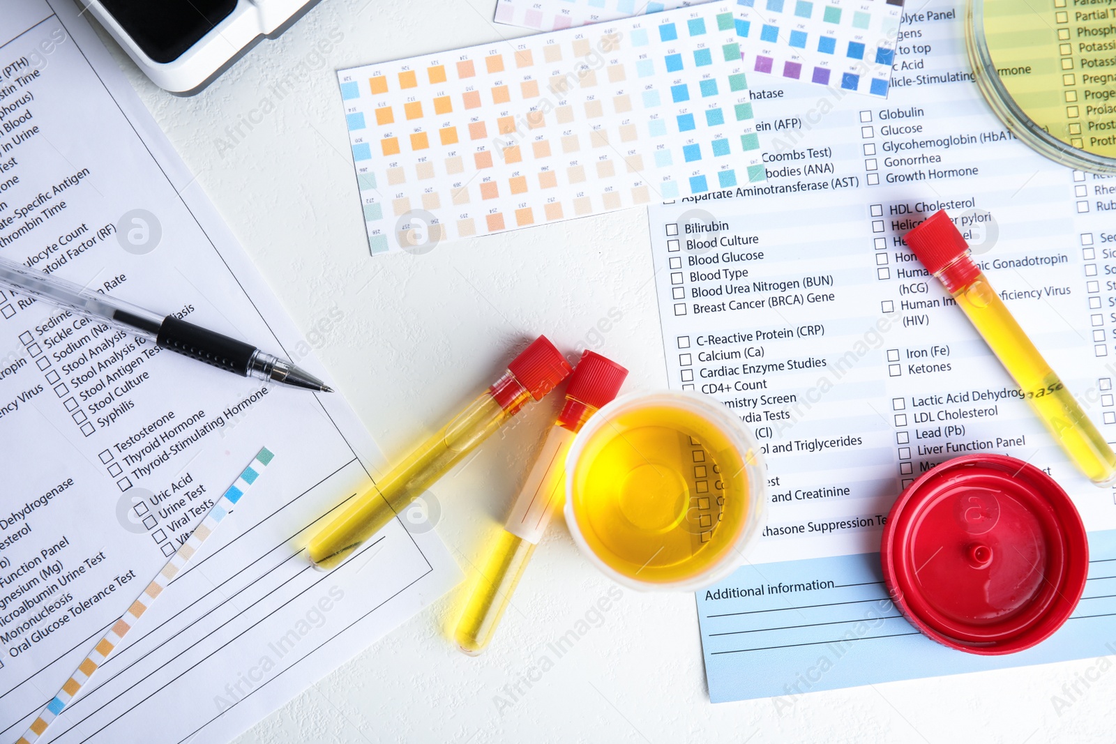 Photo of Laboratory ware with urine sample for analysis on white table, flat lay