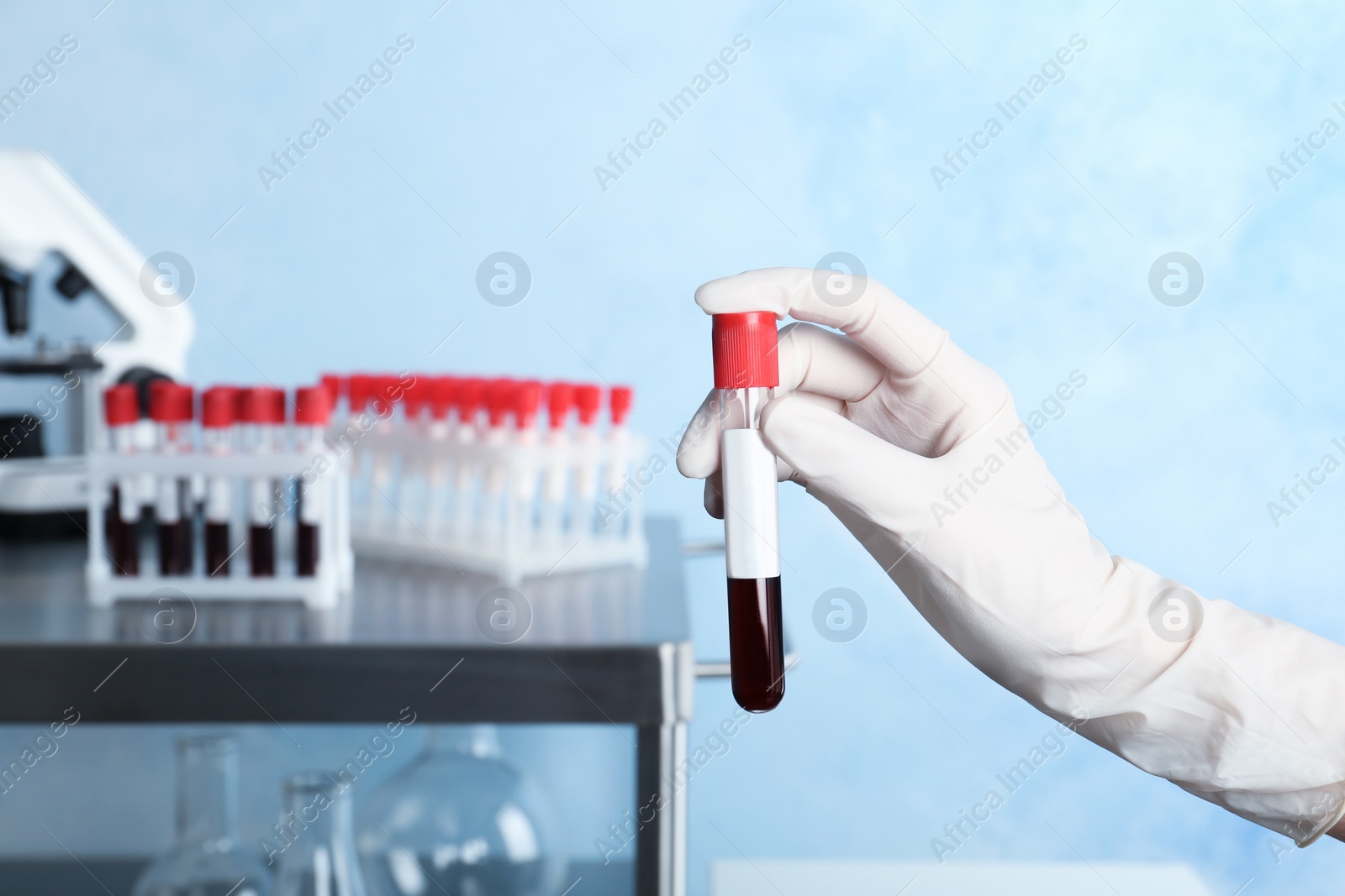 Photo of Doctor holding glass tube with blood in laboratory, closeup. Allergy test