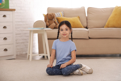 Photo of Adorable little girl with chickenpox at home