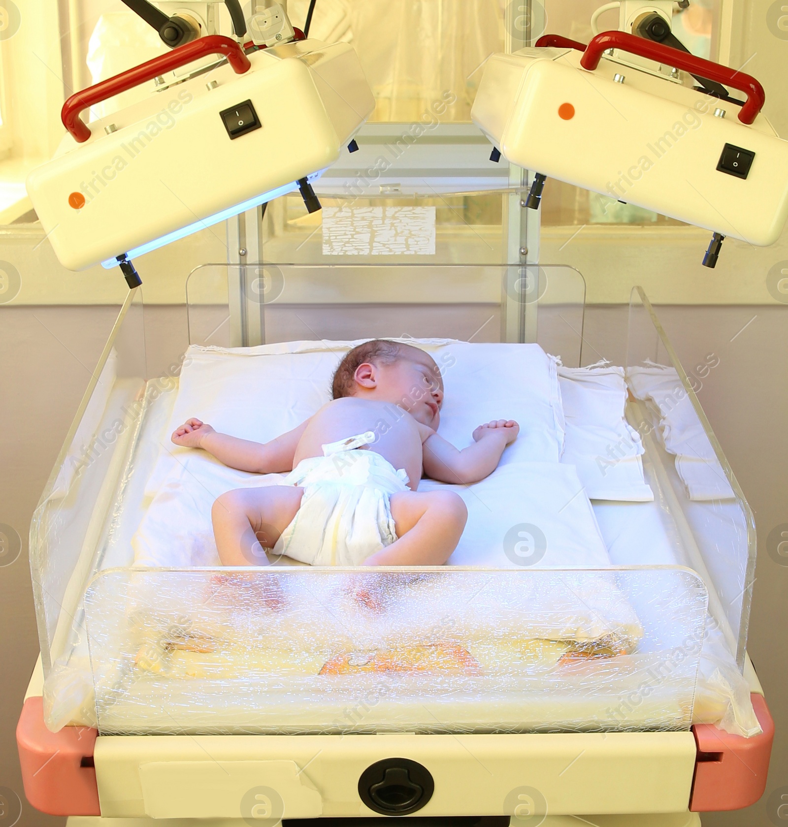 Photo of Newborn child under ultraviolet lamps in hospital