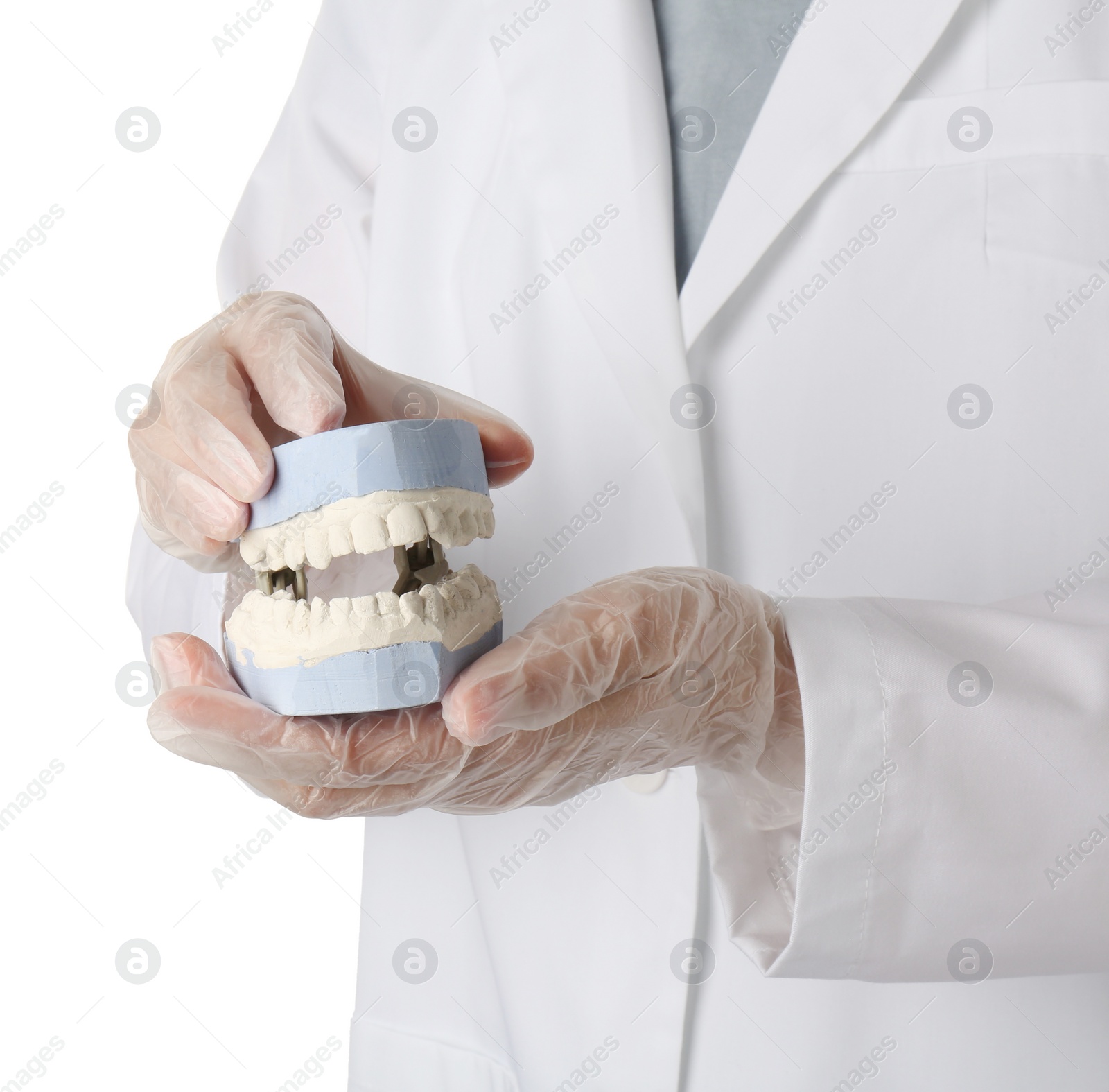 Photo of Doctor holding dental model with jaws on white background, closeup. Cast of teeth