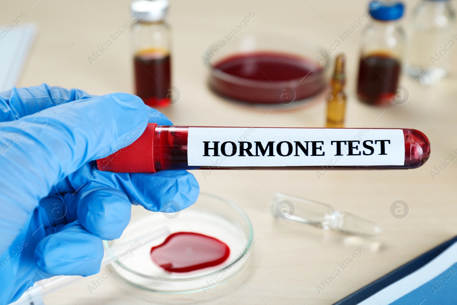 Photo of Hormones test. Scientist holding sample tube with blood at table, closeup