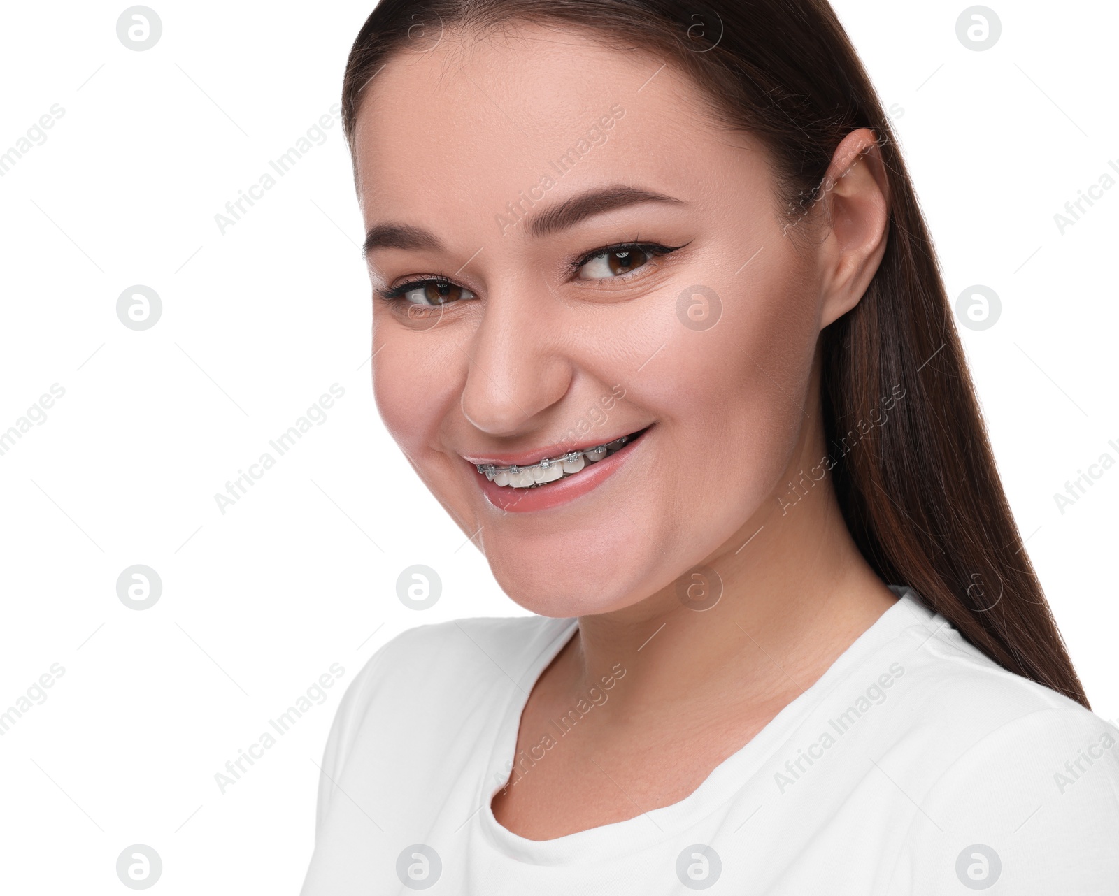 Photo of Smiling woman with dental braces on white background