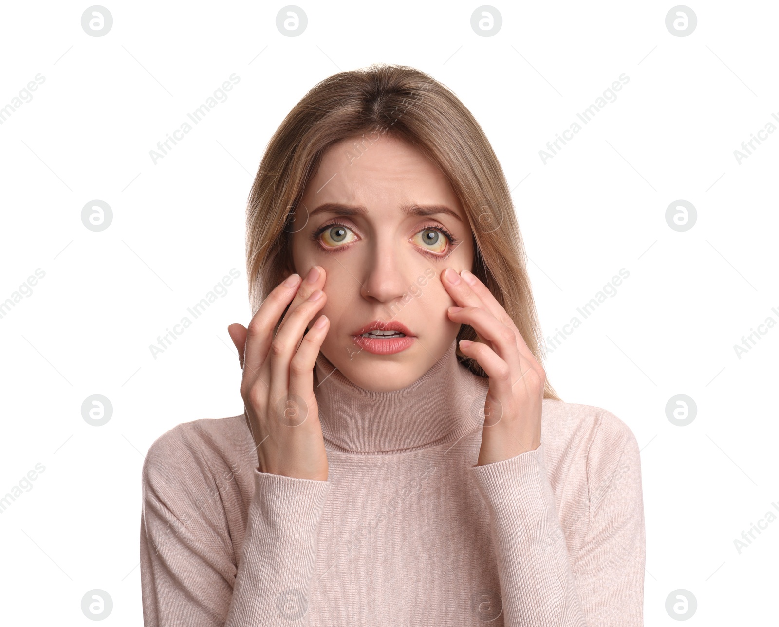 Photo of Woman checking her health condition on white background. Yellow eyes as symptom of problems with liver