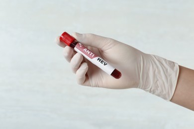 Photo of Scientist holding tube with blood sample and label ANTI HEV on light background, closeup