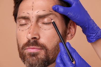 Photo of Doctor drawing marks on man's face for cosmetic surgery operation against beige background, closeup