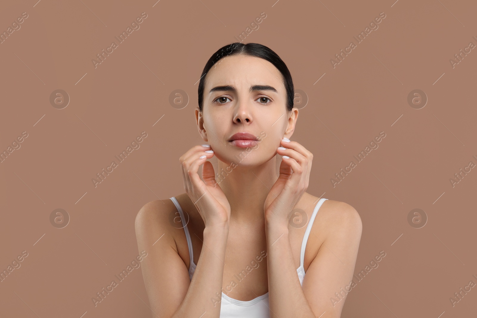 Photo of Woman with dry skin on beige background