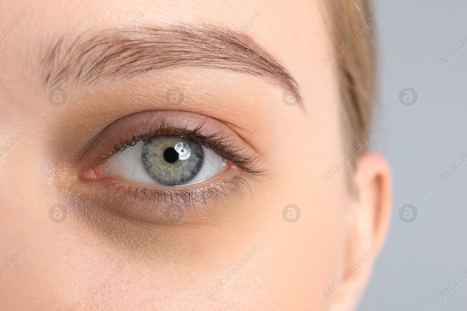 Image of Tired young woman with dark circle under eye, closeup