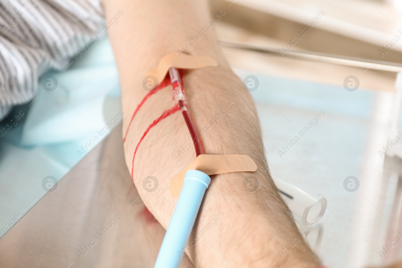 Photo of Man making blood donation at hospital, closeup