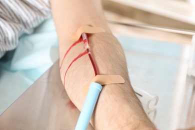 Man making blood donation at hospital, closeup