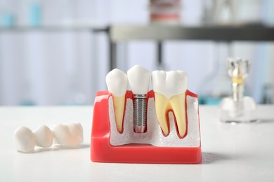 Educational model of gum with dental implant between teeth on white table indoors