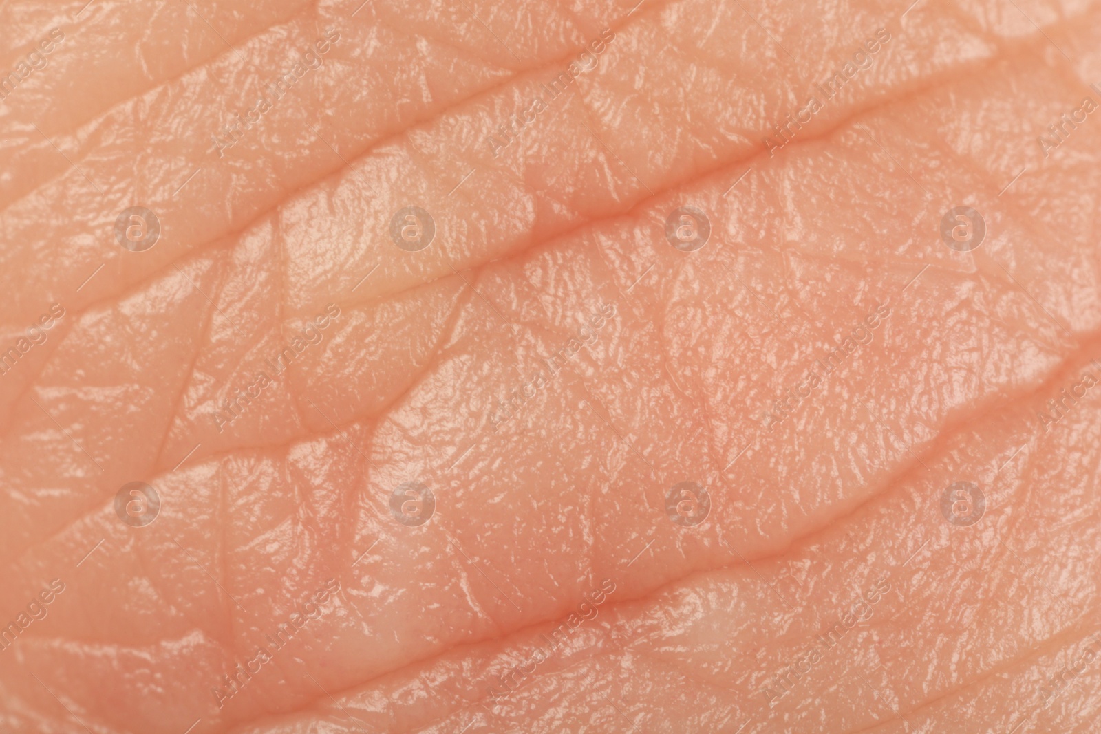 Photo of Texture of healthy skin as background, macro view