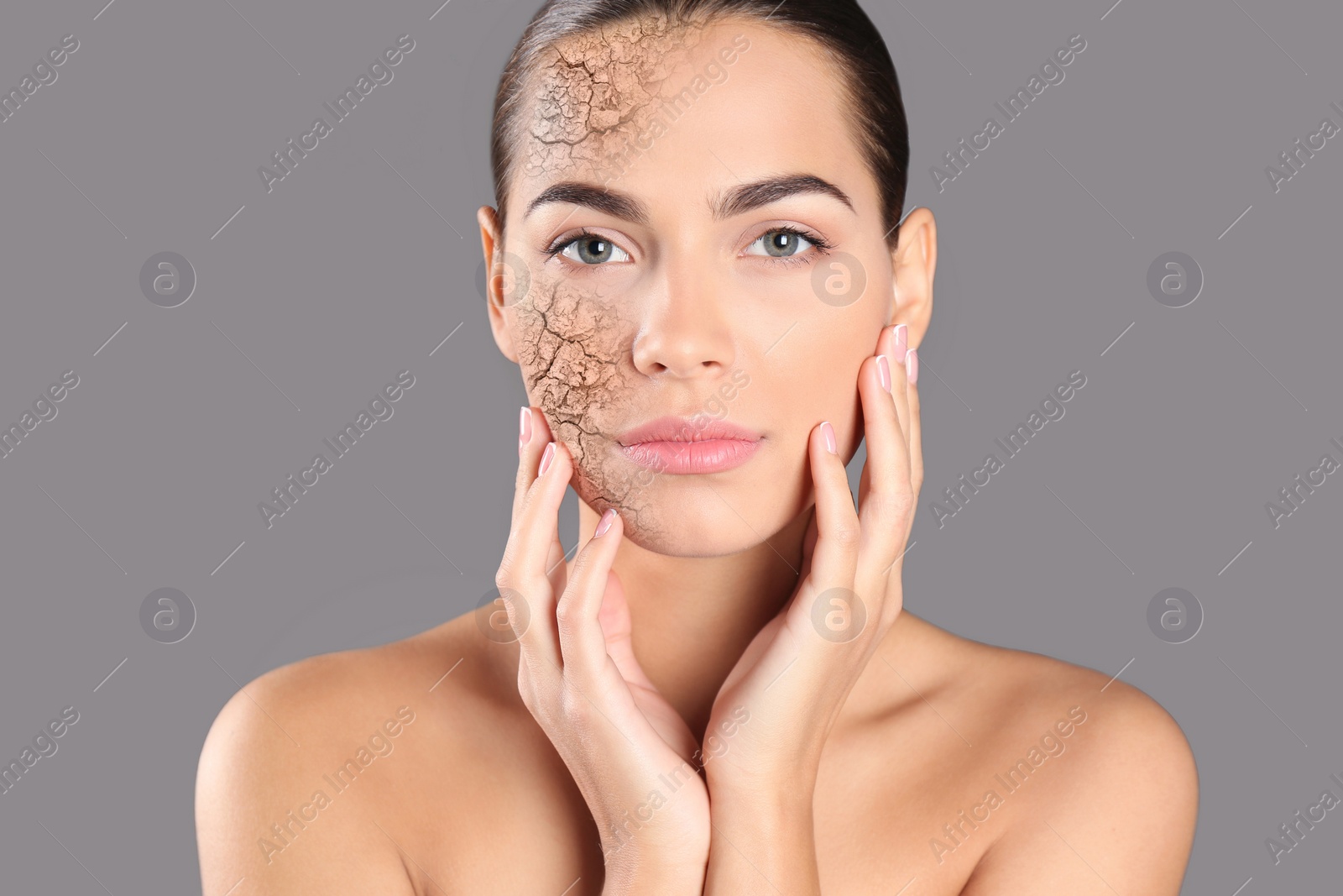 Image of Beautiful young woman with dry skin on grey background