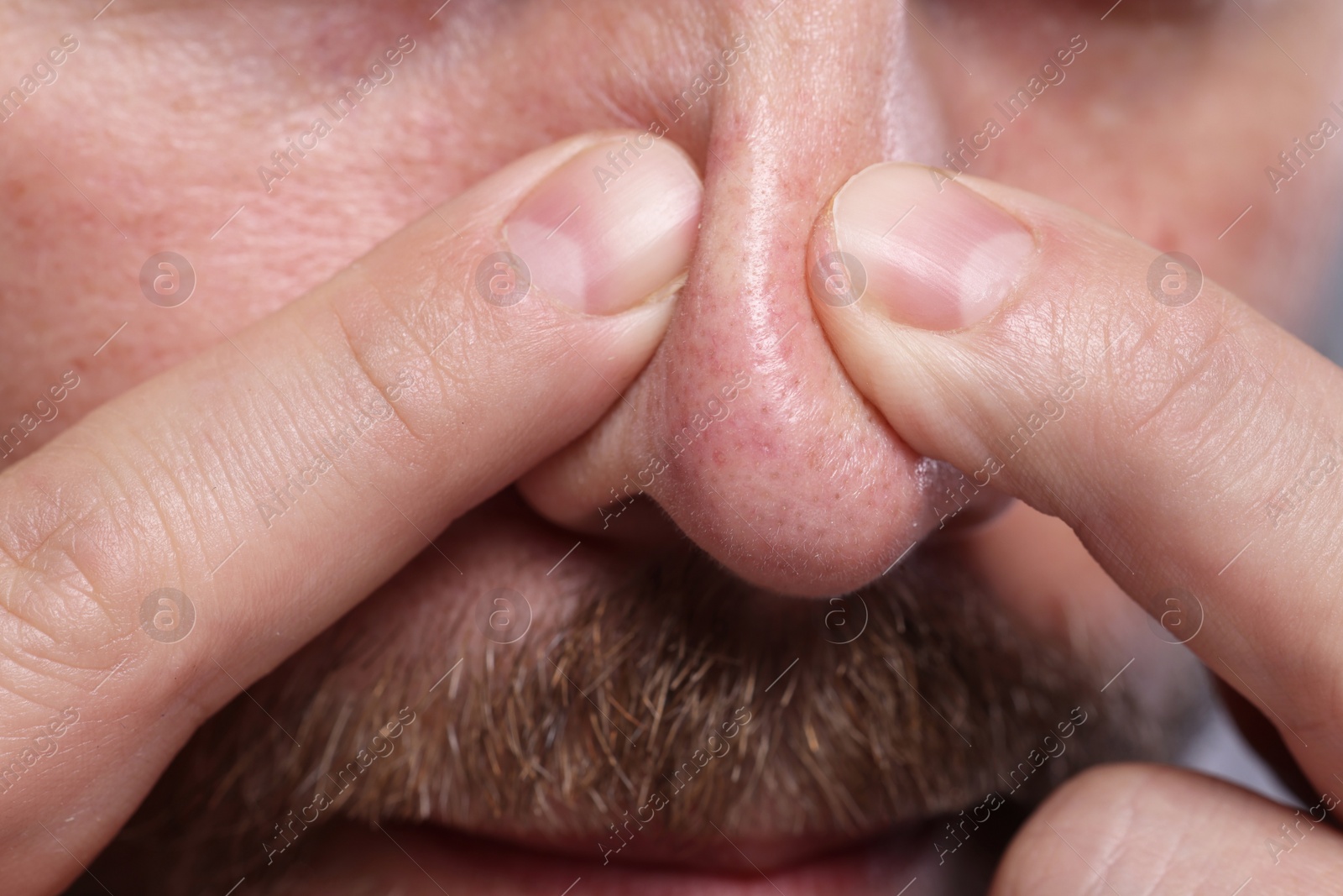 Photo of Man popping pimple on his nose, closeup