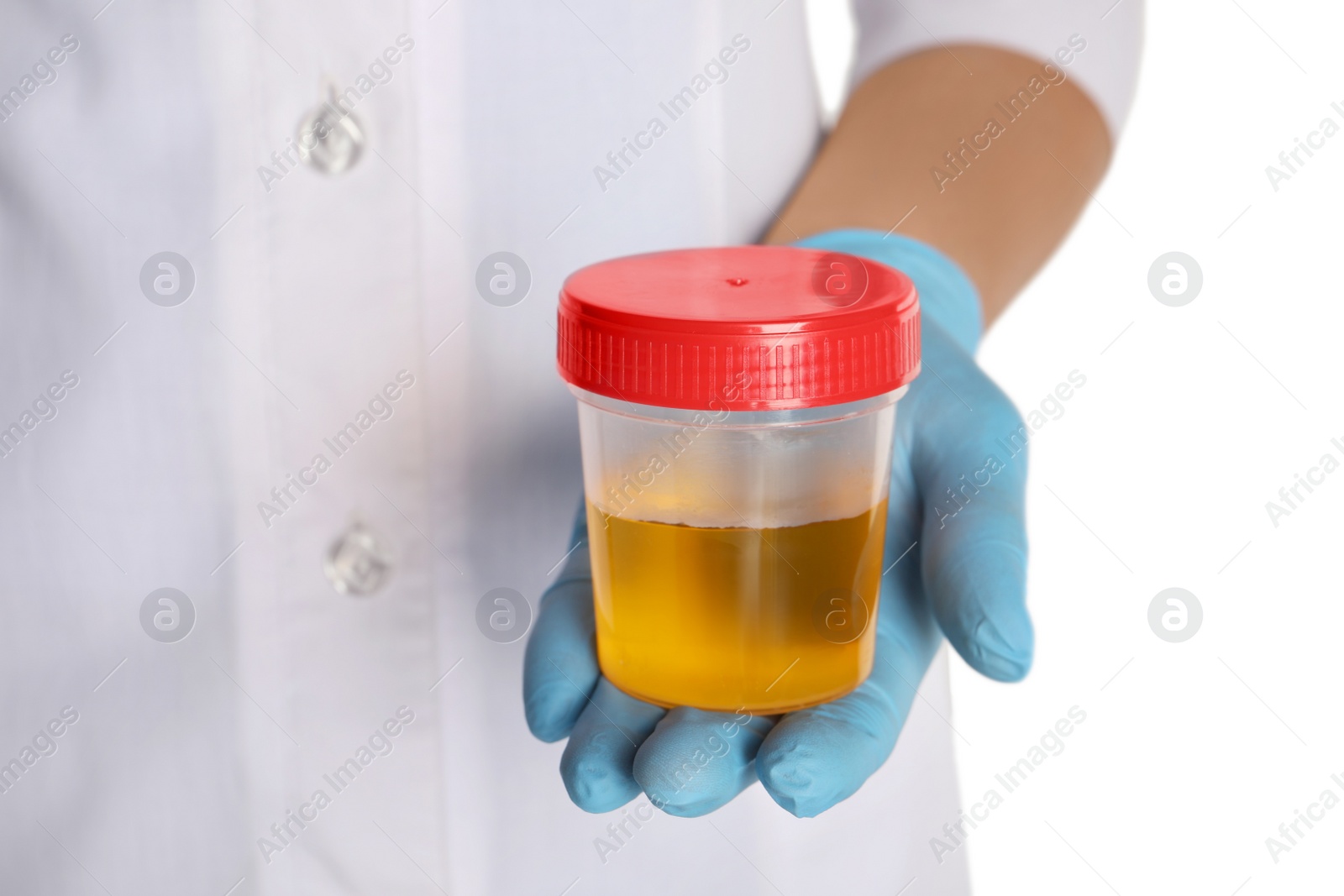 Photo of Nurse holding container with urine sample for analysis on white background, closeup