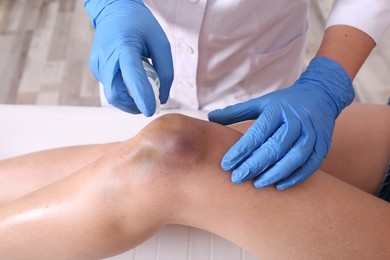 Photo of Doctor spraying woman's knee bruise in hospital, closeup