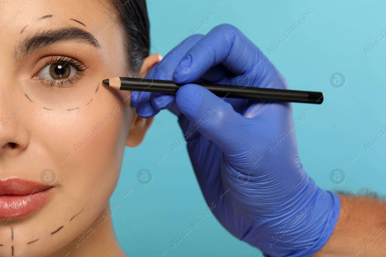 Photo of Doctor with pencil preparing patient for cosmetic surgery operation on light blue background, closeup