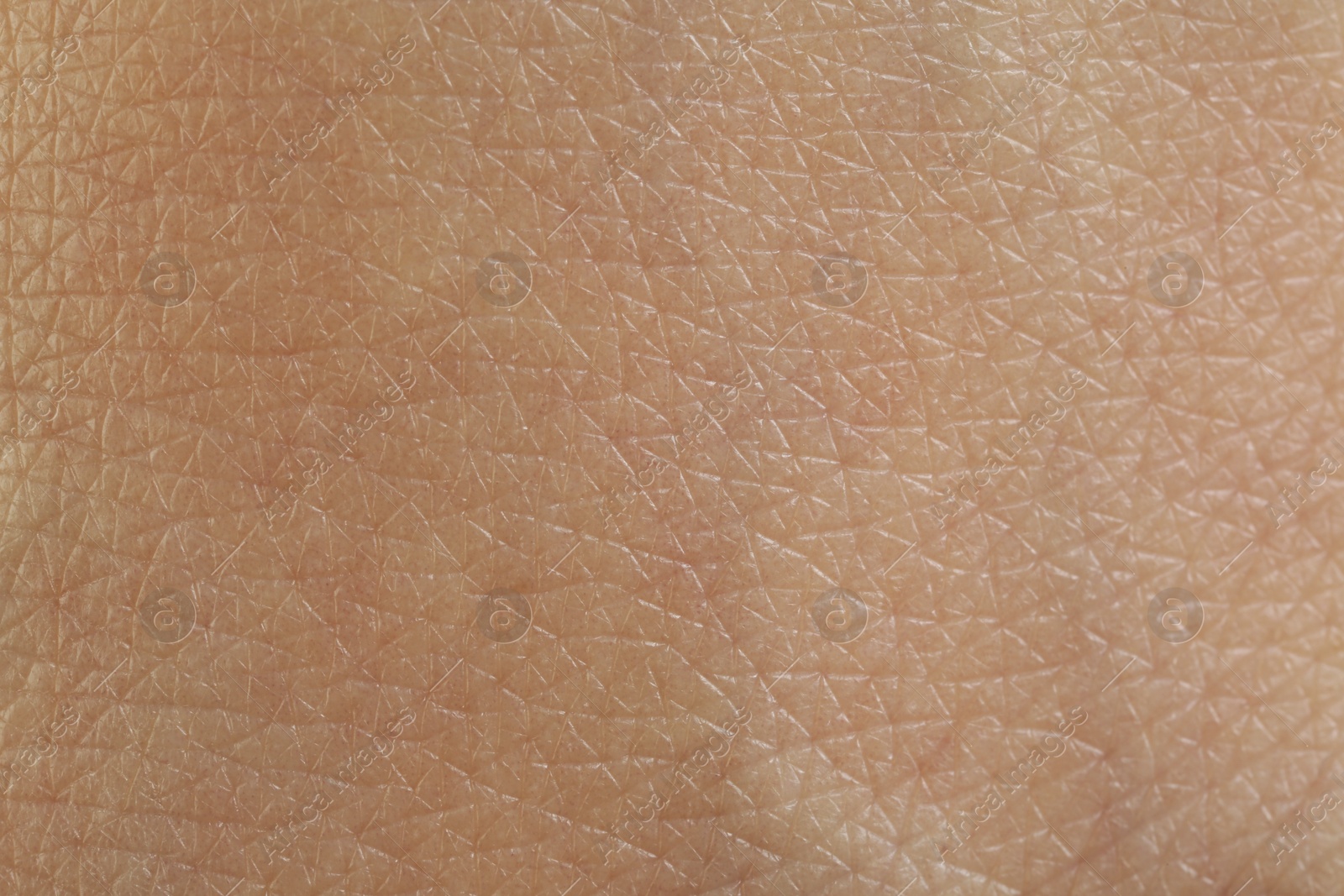 Photo of Texture of healthy skin as background, macro view