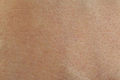 Photo of Texturehealthy skin as background, macro view