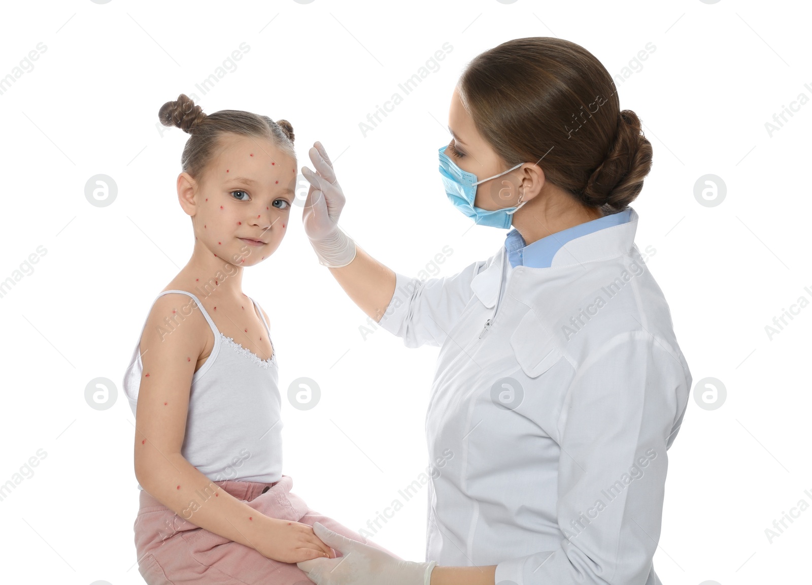 Photo of Doctor examining little girl with chickenpox on white background. Varicella zoster virus