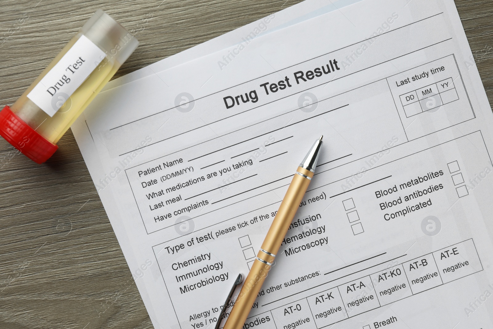 Photo of Drug test result form, container with urine sample and pen on wooden table, flat lay